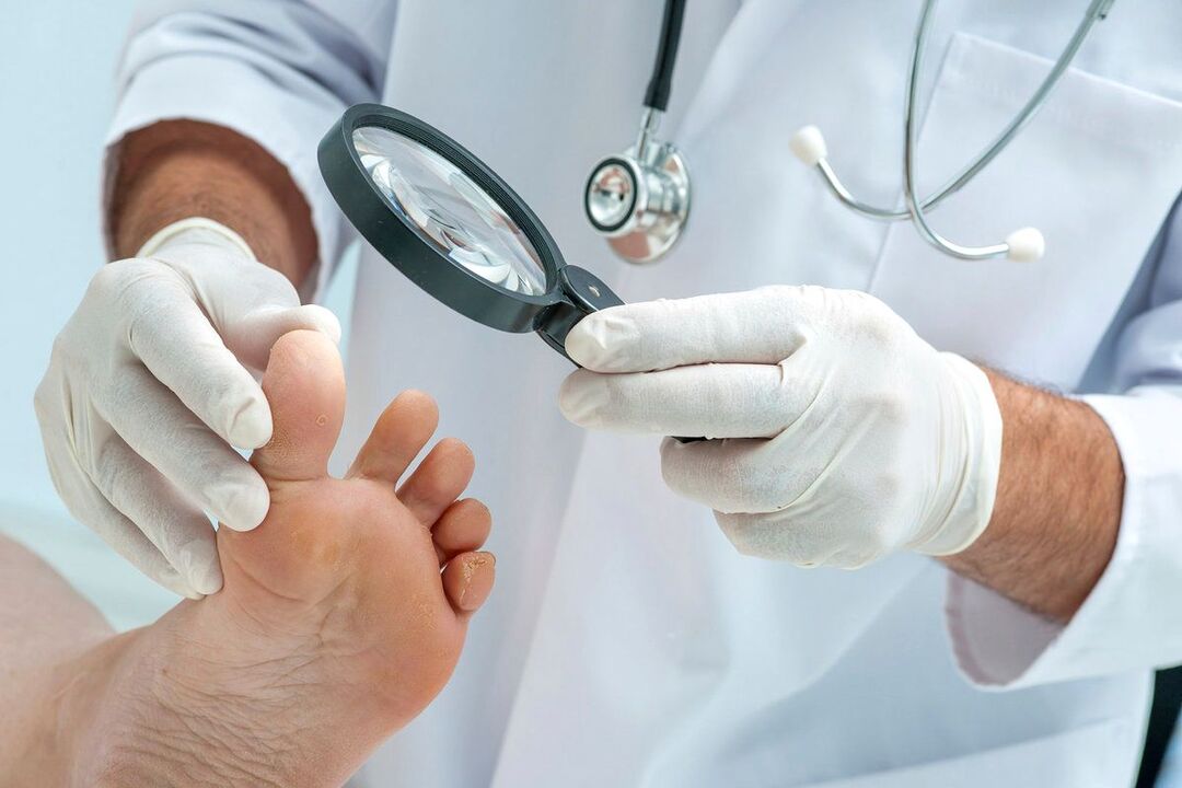 arst uurib jalgu seenhaigusega