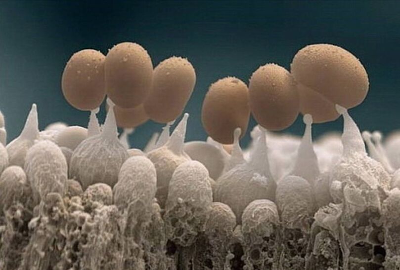 varbaküünte seen mikroskoobi all