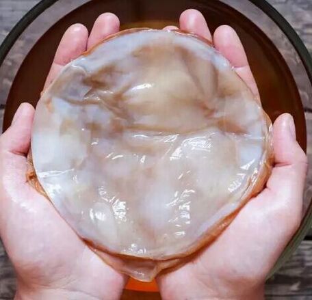 küünte seen kombucha