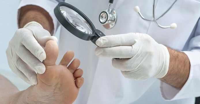arst uurib jalgu küünte seenhaiguste suhtes